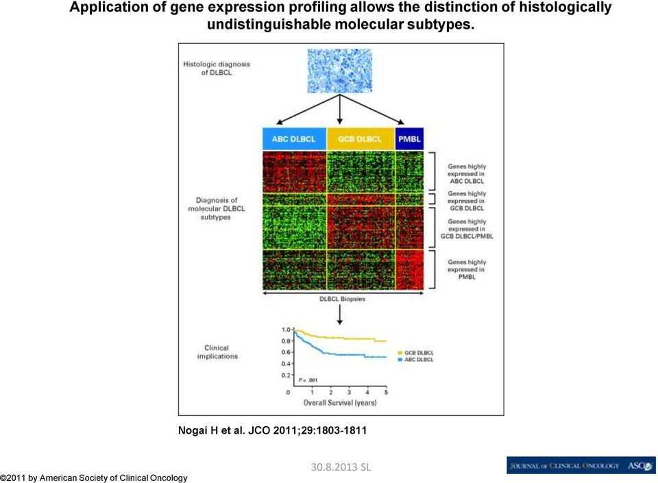 undistinguishable molecular subtypes.