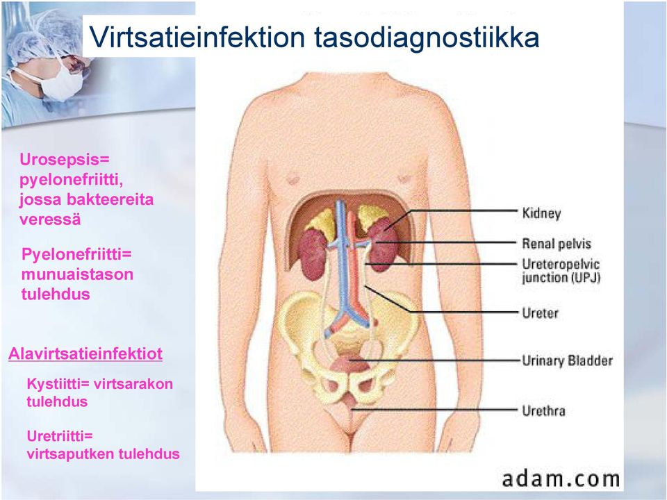 Pyelonefriitti= munuaistason tulehdus