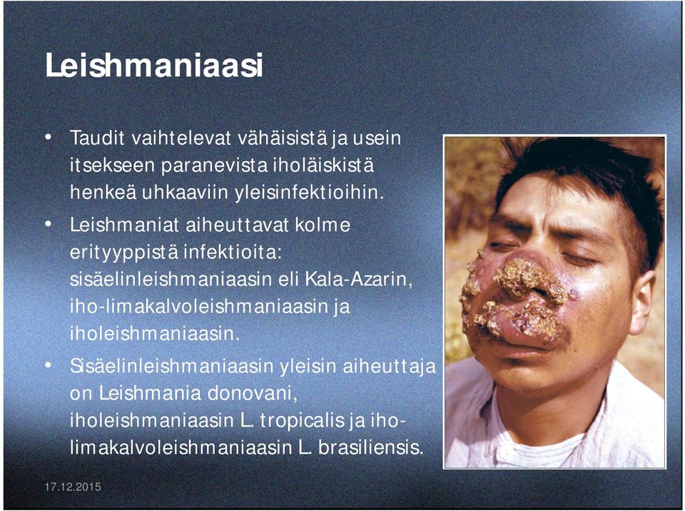 Leishmaniat aiheuttavat kolme erityyppistä infektioita: sisäelinleishmaniaasin eli Kala-Azarin,