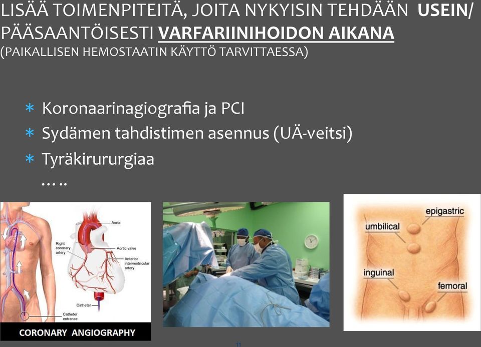 HEMOSTAATIN KÄYTTÖ TARVITTAESSA) * Koronaarinagiografia