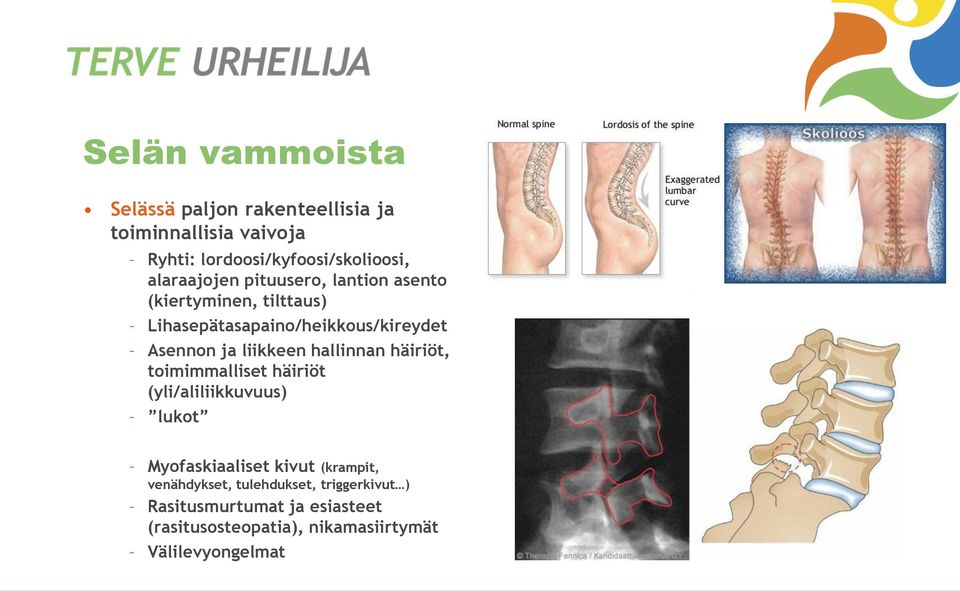 liikkeen hallinnan häiriöt, toimimmalliset häiriöt (yli/aliliikkuvuus) lukot Myofaskiaaliset kivut (krampit,