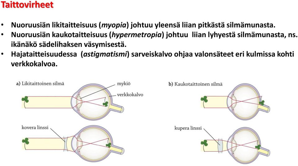 Nuoruusiän kaukotaitteisuus (hypermetropia) johtuu liian lyhyestä