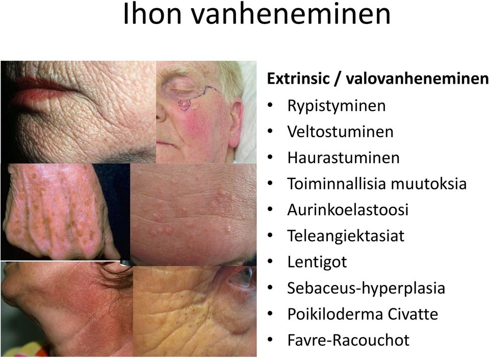 Toiminnallisia muutoksia Aurinkoelastoosi