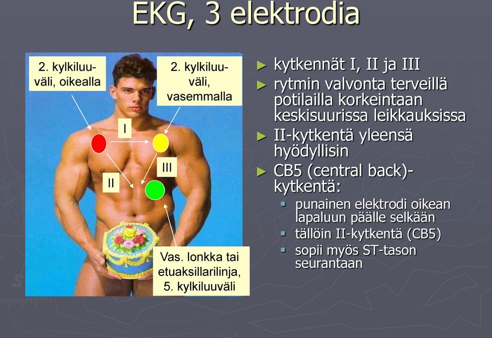 kylkiluuväli kytkennät I, II ja III rytmin valvonta terveillä potilailla korkeintaan keskisuurissa