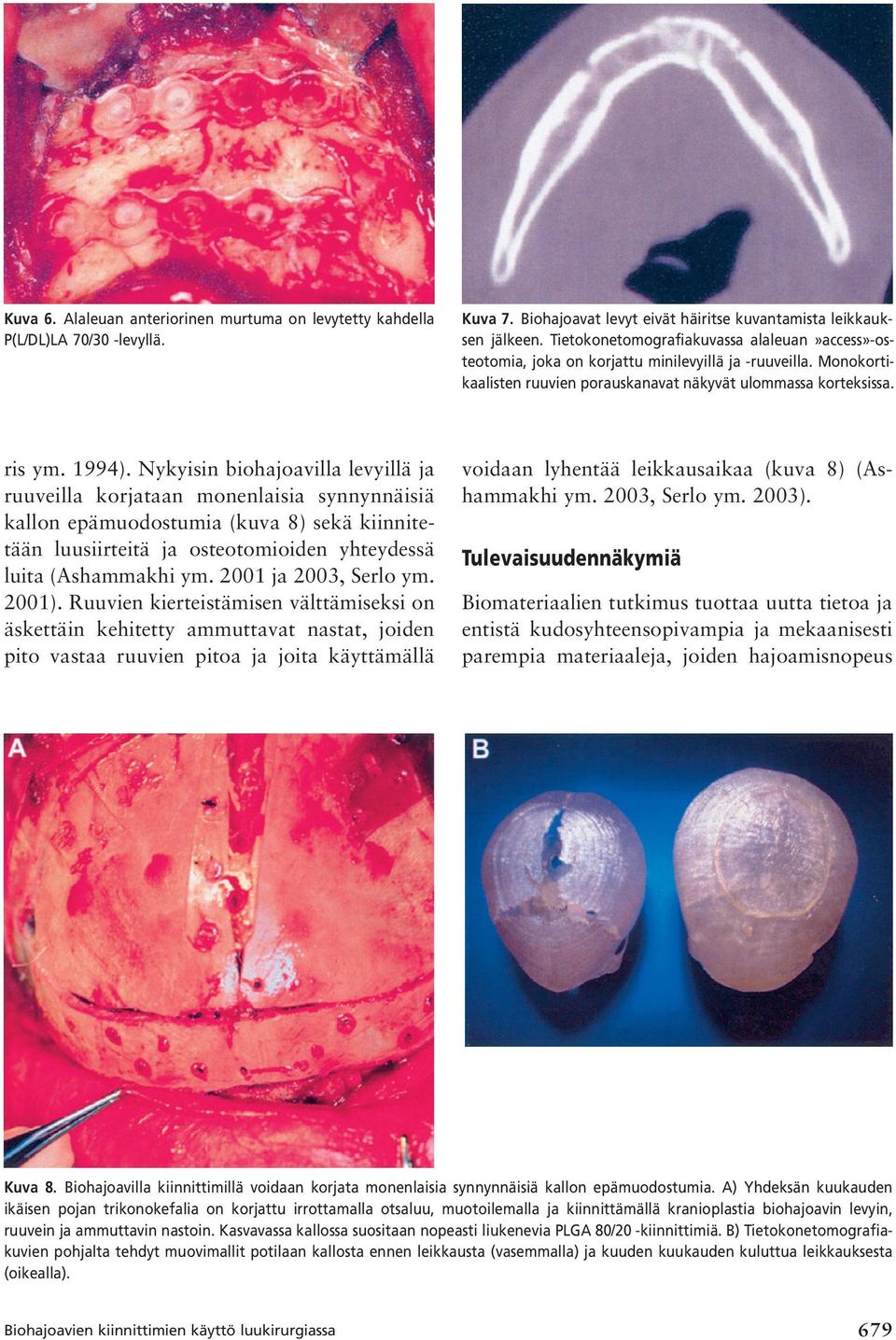 Nykyisin biohajoavilla levyillä ja ruuveilla korjataan monenlaisia synnynnäisiä kallon epämuodostumia (kuva 8) sekä kiinnitetään luusiirteitä ja osteotomioiden yhteydessä luita (Ashammakhi ym.