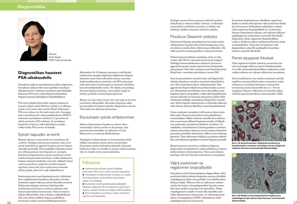 Diagnoosi perustuu histologiseen biopsialöydökseen.