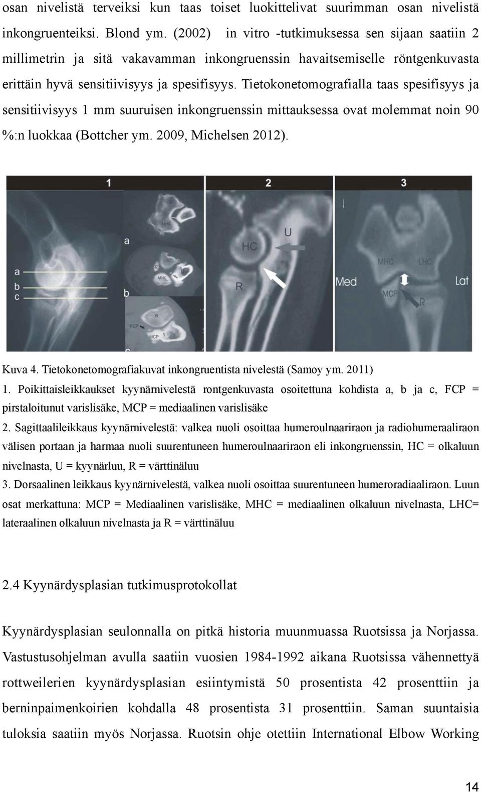 Tietokonetomografialla taas spesifisyys ja sensitiivisyys 1 mm suuruisen inkongruenssin mittauksessa ovat molemmat noin 90 %:n luokkaa (Bottcher ym. 2009, Michelsen 2012). Kuva 4.