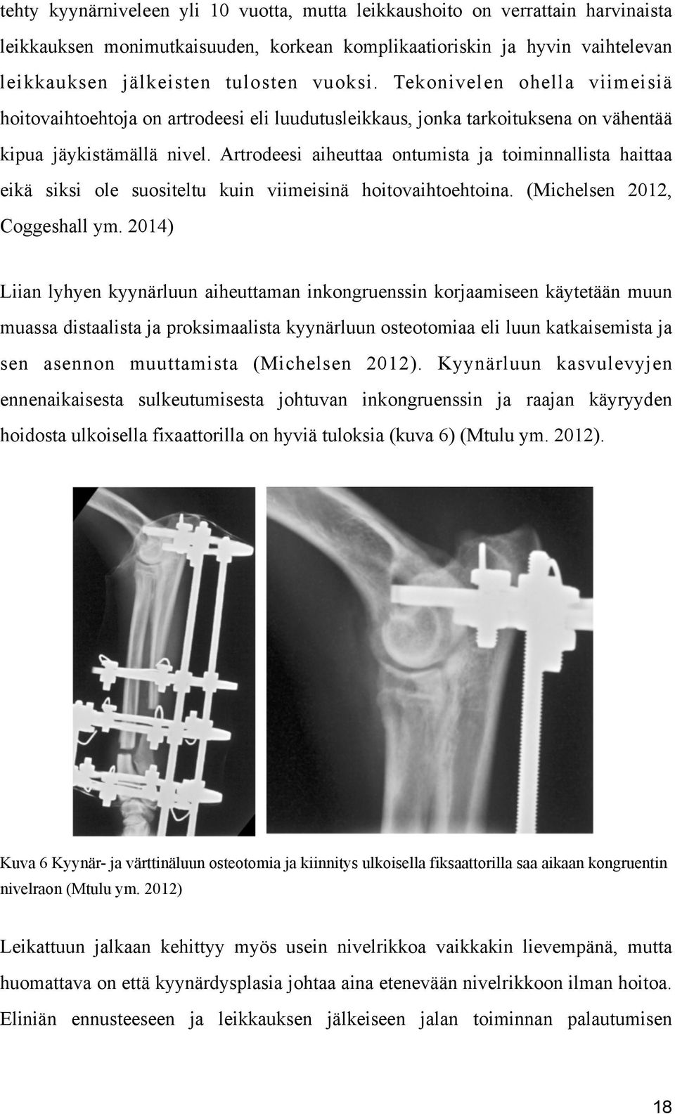 Artrodeesi aiheuttaa ontumista ja toiminnallista haittaa eikä siksi ole suositeltu kuin viimeisinä hoitovaihtoehtoina. (Michelsen 2012, Coggeshall ym.