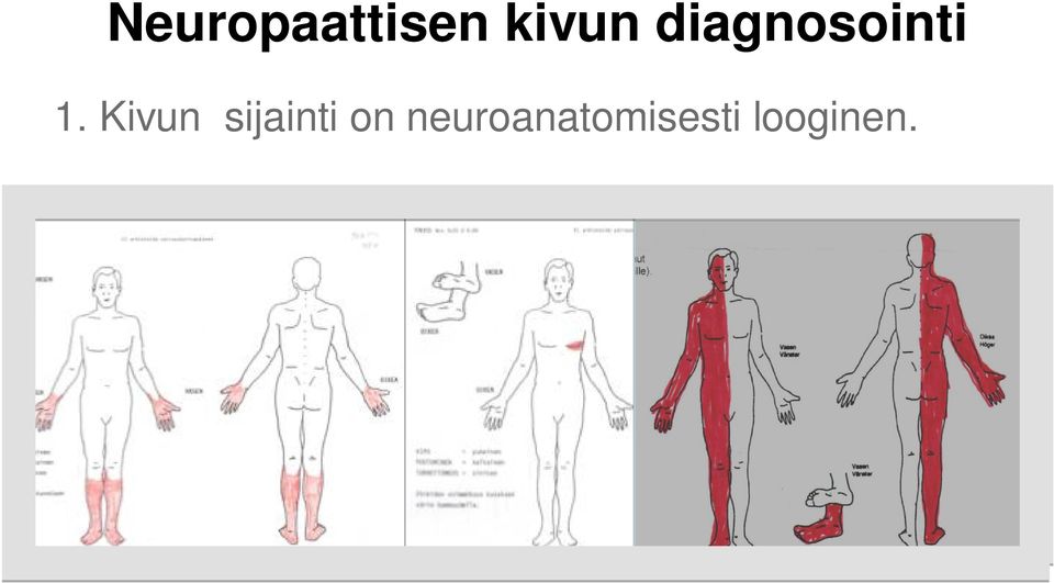 Kivun sijainti on