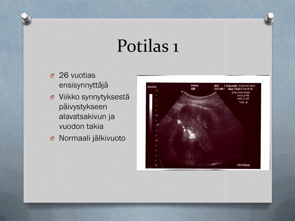 synnytyksestä päivystykseen