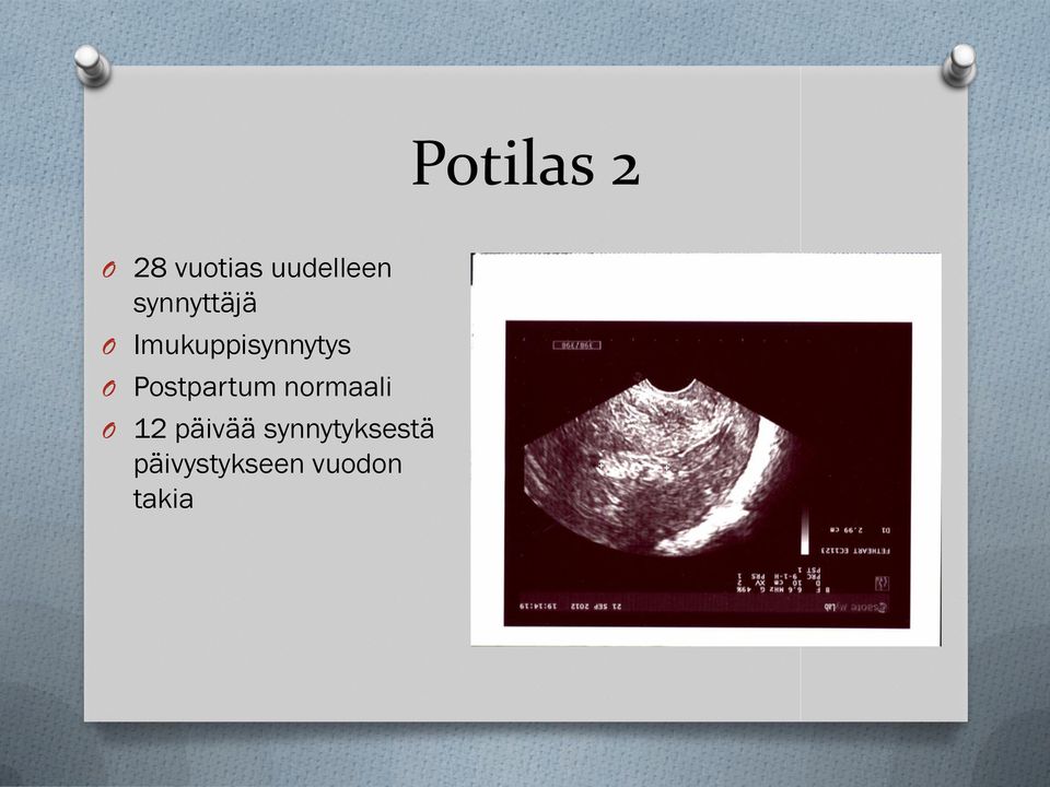 Postpartum normaali O 12 päivää