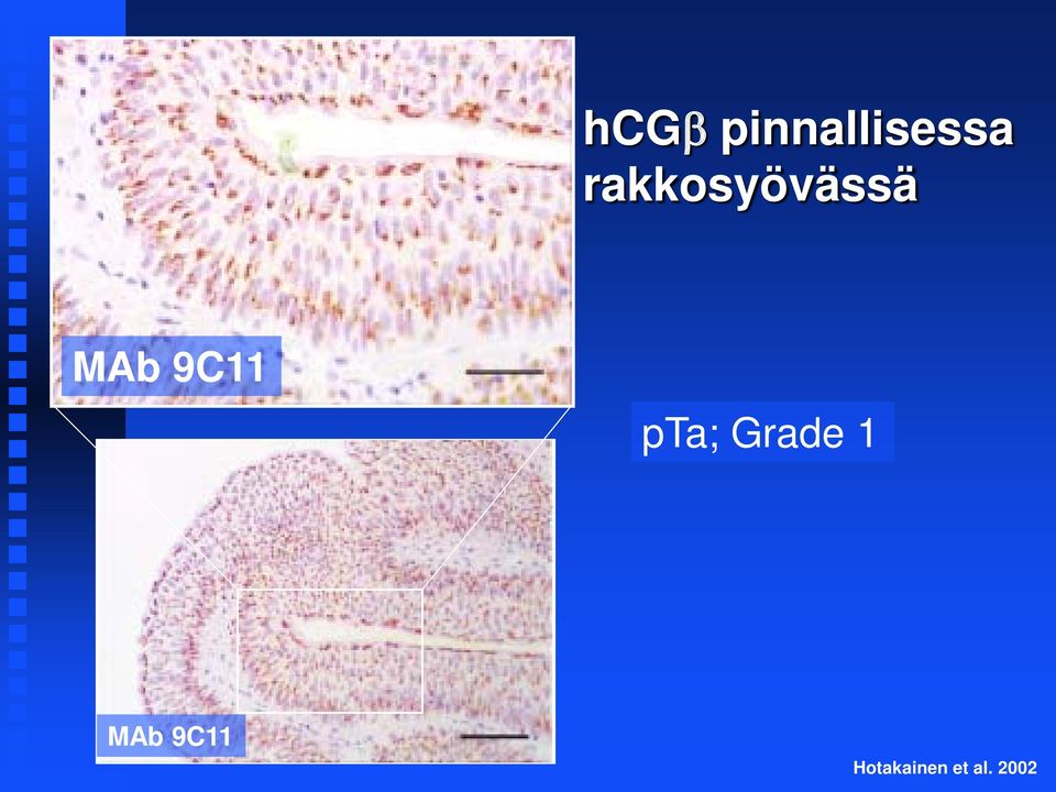 9C11 pta; Grade 1 MAb