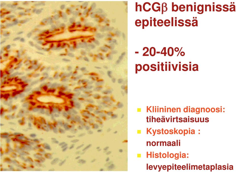 tiheävirtsaisuus Kystoskopia :