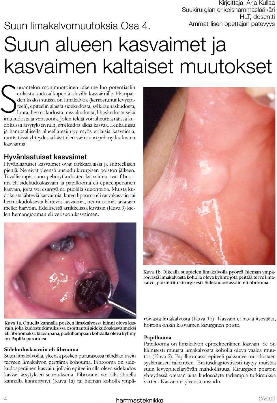 potentiaalin erilaista kudosalkuperää oleville kasvaimille.