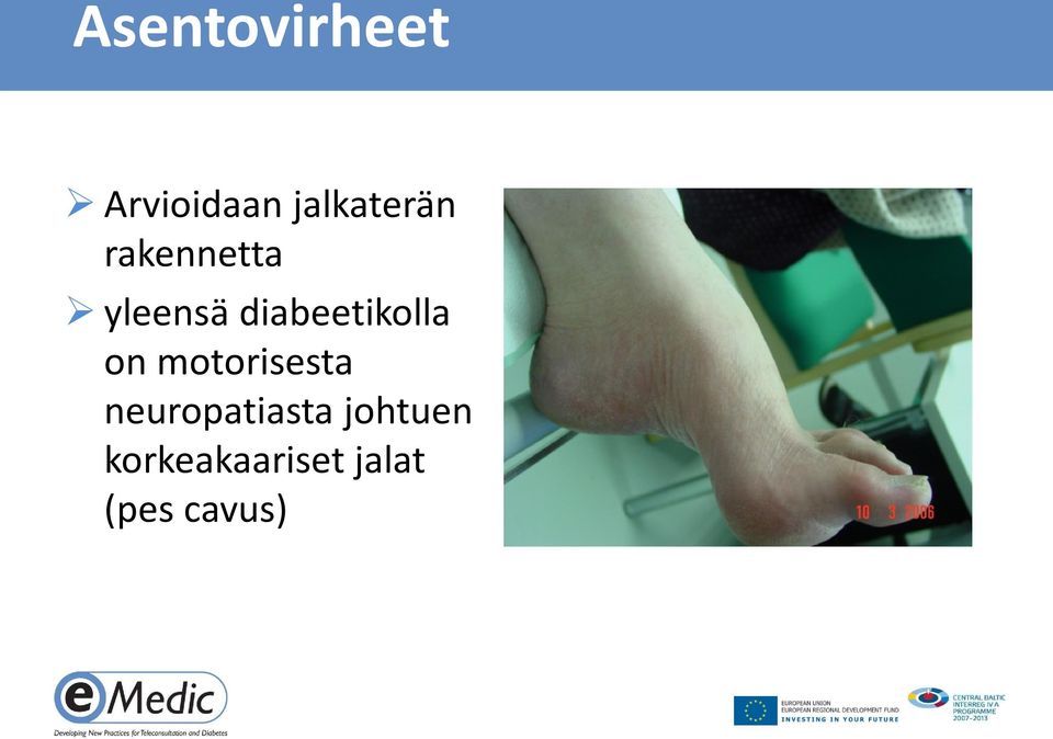 diabeetikolla on motorisesta