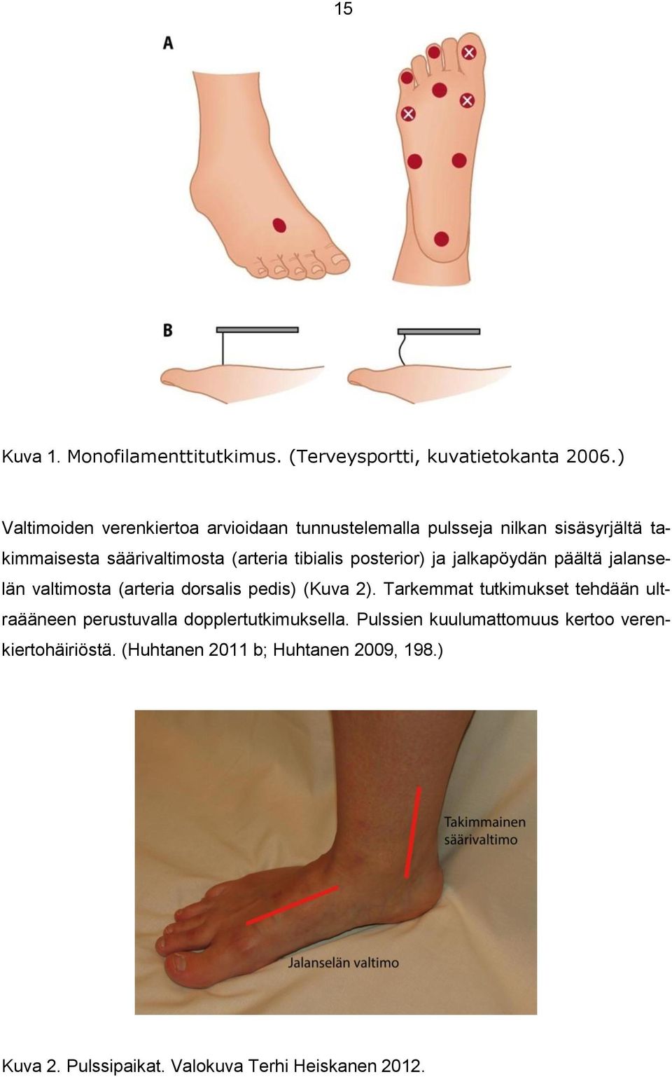 tibialis posterior) ja jalkapöydän päältä jalanselän valtimosta (arteria dorsalis pedis) (Kuva 2).