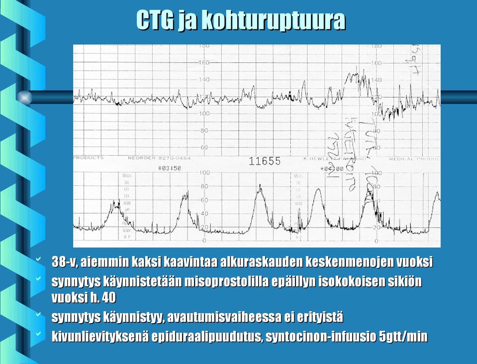 isokokoisen sikiön vuoksi h.