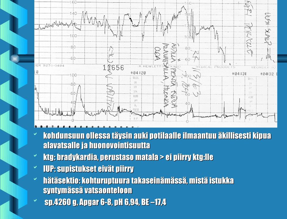 piirry ktg:lle IUP: supistukset eivät piirry hätäsektio: kohturuptuura