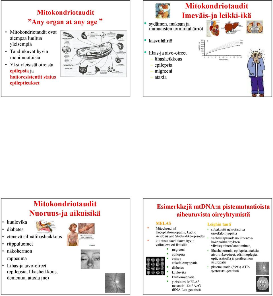 kuulovika diabetes etenevä silmälihasheikkous riippuluomet näköhermon rappeuma Lihas-ja aivo-oireet (epilepsia, lihasheikkous, dementia, ataxia jne) Esimerkkejä mtdna:n pistemutaatioista aiheutuvista