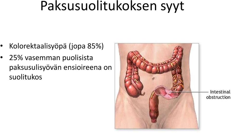 25% vasemman puolisista