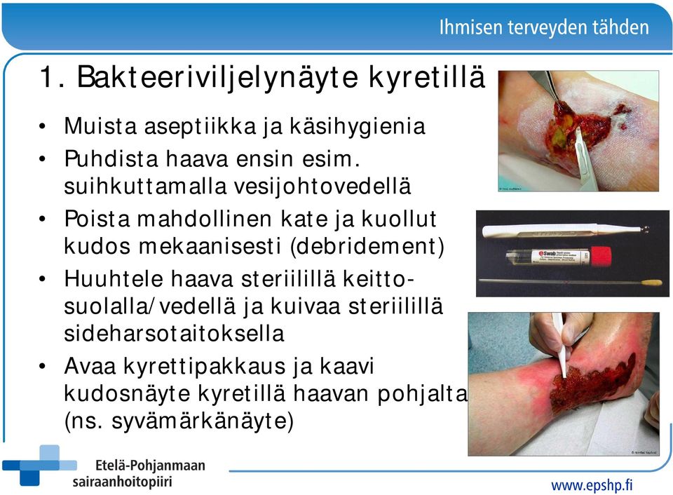 (debridement) Huuhtele haava steriilillä keittosuolalla/vedellä ja kuivaa steriilillä