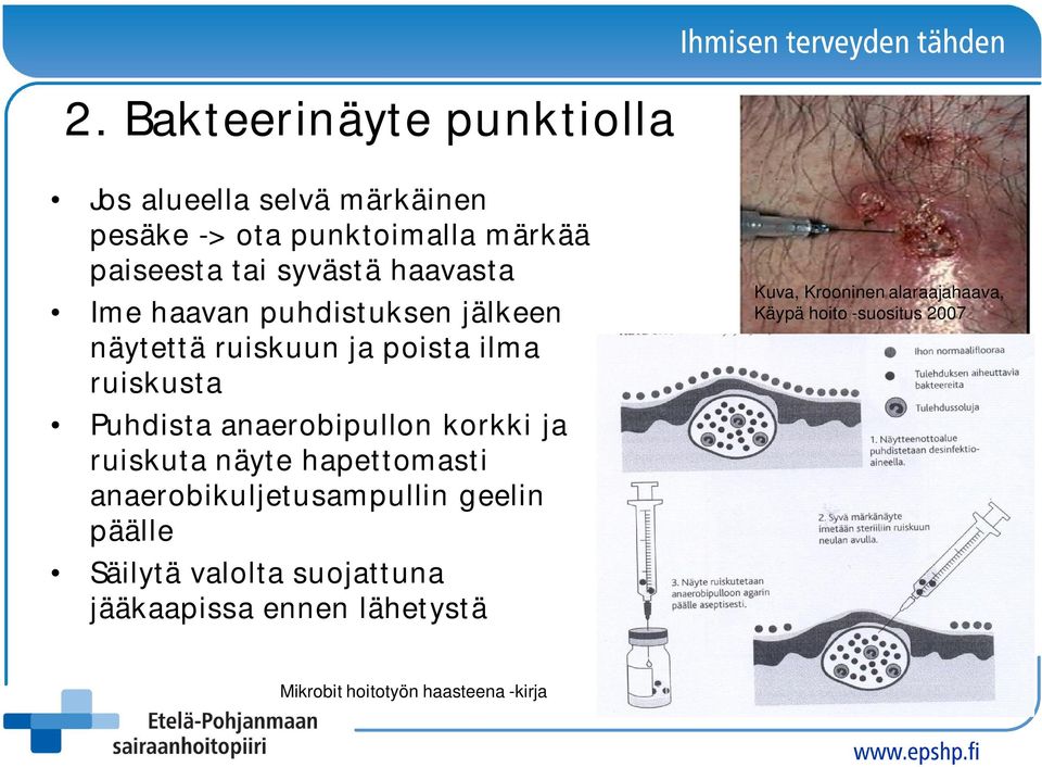 anaerobipullon korkki ja ruiskuta näyte hapettomasti anaerobikuljetusampullin geelin päälle Säilytä valolta