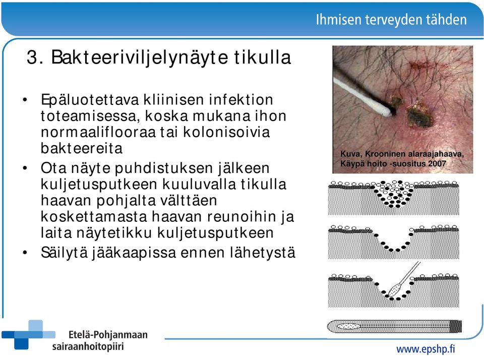 kuuluvalla tikulla haavan pohjalta välttäen koskettamasta haavan reunoihin ja laita näytetikku