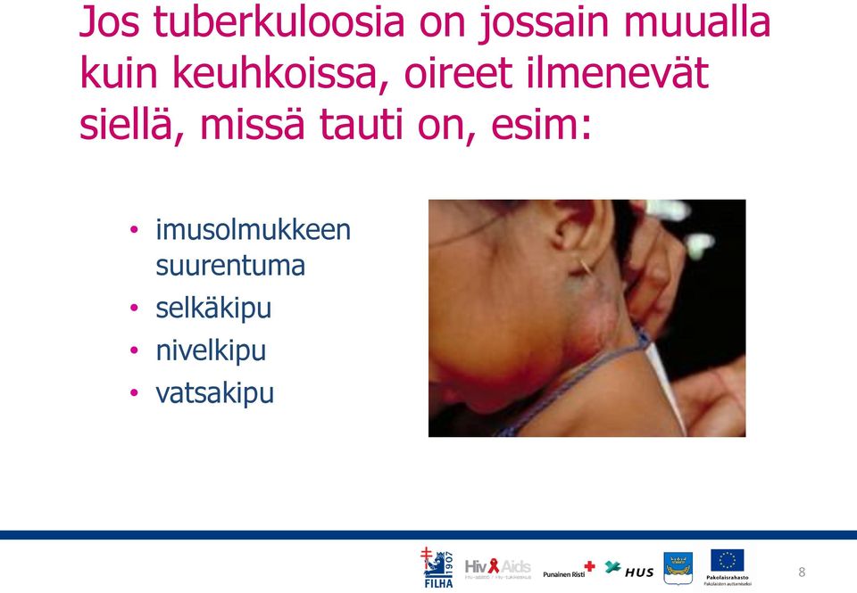 siellä, missä tauti on, esim: