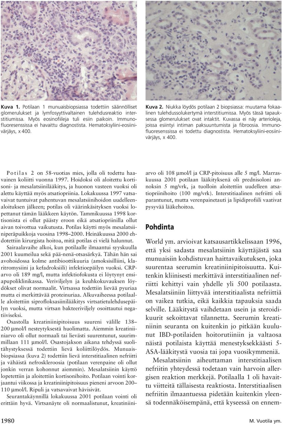 Myös tässä tapauksessa glomerulukset ovat intaktit. Kuvassa ei näy arterioleja, joissa esiintyi intiman paksuuntumista ja fibroosia. Immunofluoresenssissa ei todettu diagnostista.