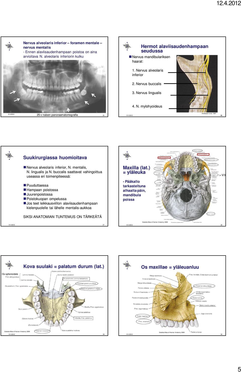1997 25 26 Suukirurgiassa huomioitava Maxilla (lat.) = yläleuka Nervus alveolaris inferior, N. mentalis, N. lingualis ja N.