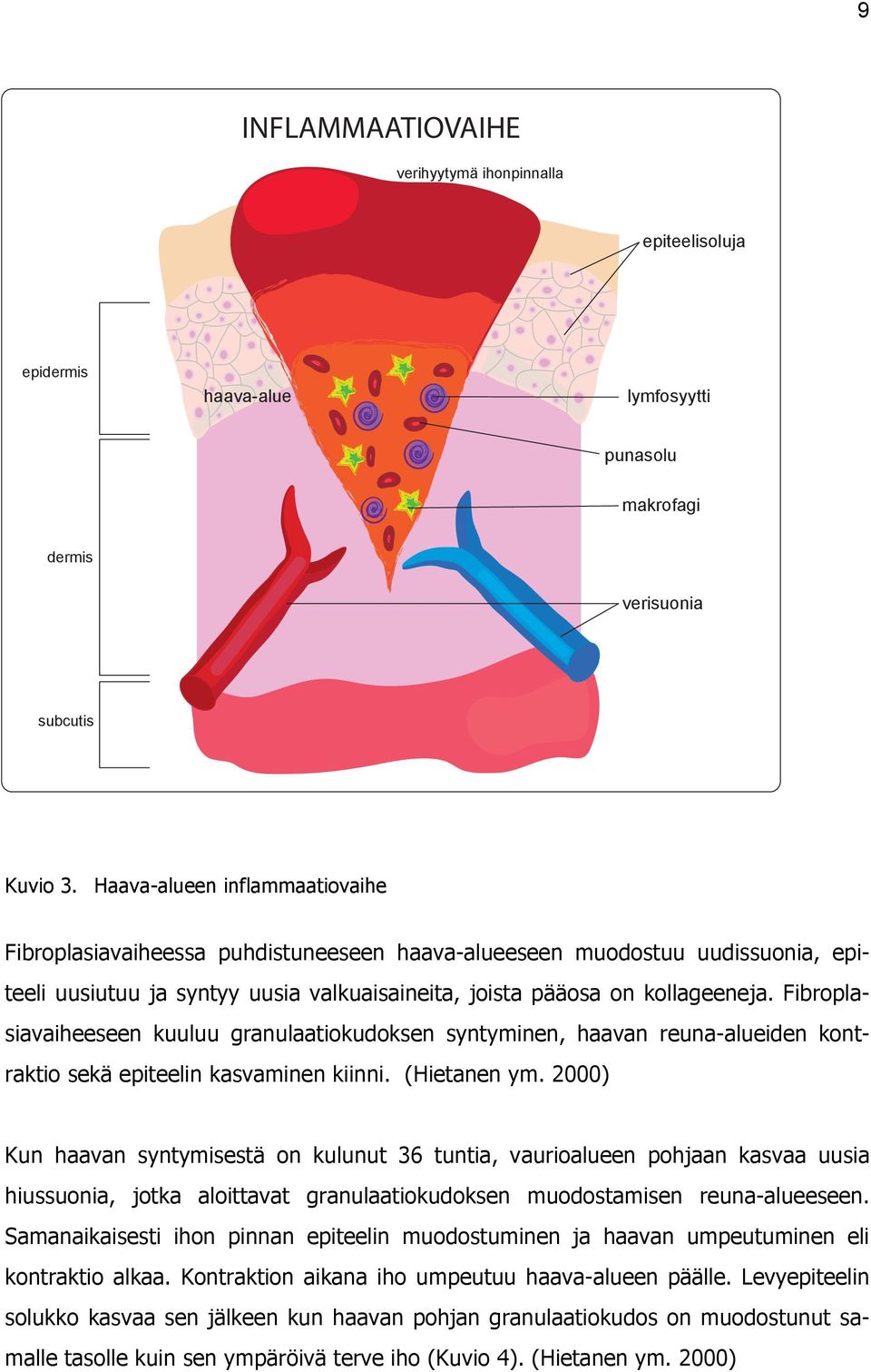 Fibroplasiavaiheeseen kuuluu granulaatiokudoksen syntyminen, haavan reuna-alueiden kontraktio sekä epiteelin kasvaminen kiinni. (Hietanen ym.