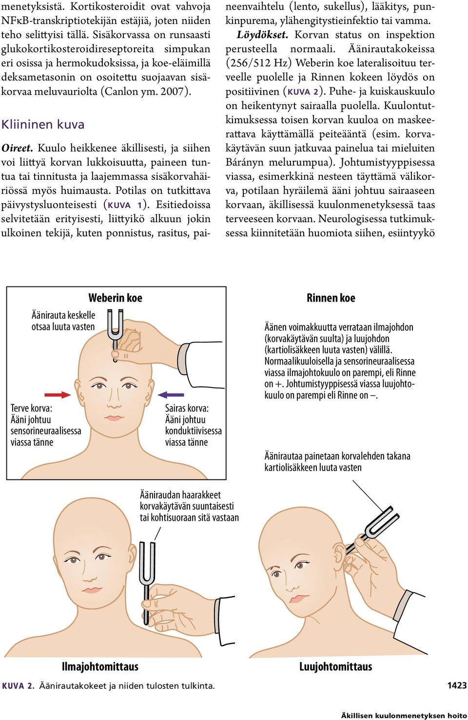 Kliininen kuva Oireet. Kuulo heikkenee äkillisesti, ja siihen voi liittyä korvan lukkoisuutta, paineen tuntua tai tinnitusta ja laajemmassa sisäkorvahäiriössä myös huimausta.