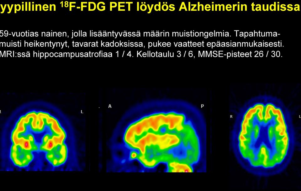 Tapahtumauisti heikentynyt, tavarat kadoksissa, pukee vaatteet