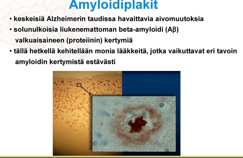 valkuaisaineen (proteiinin) kertymiä tällä hetkellä kehitellään