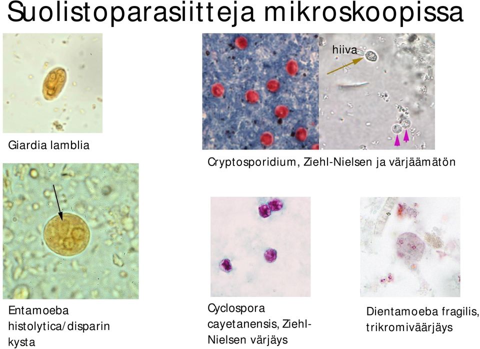 Entamoeba histolytica/disparin kysta Cyclospora
