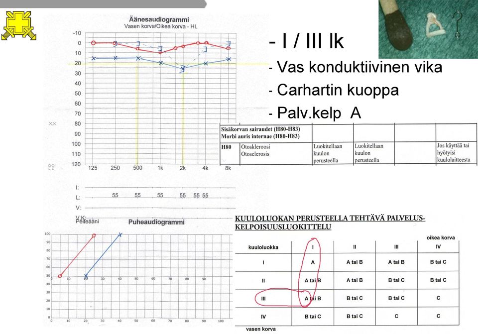 konduktiivinen