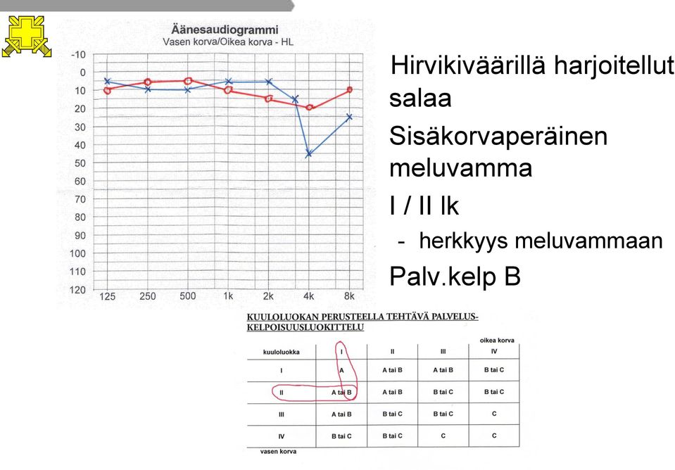 Sisäkorvaperäinen meluvamma