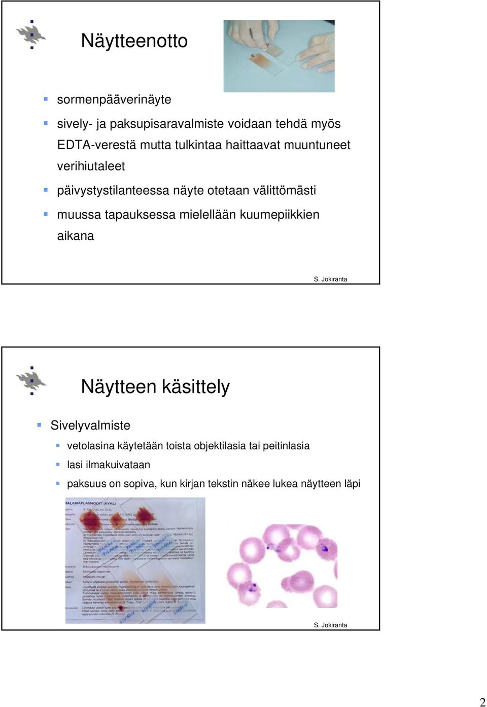 tapauksessa mielellään kuumepiikkien aikana J ki Näytteen käsittely Sivelyvalmiste vetolasina käytetään