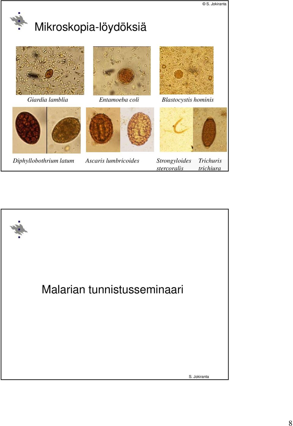 Ascaris lumbricoides Strongyloides stercoralis