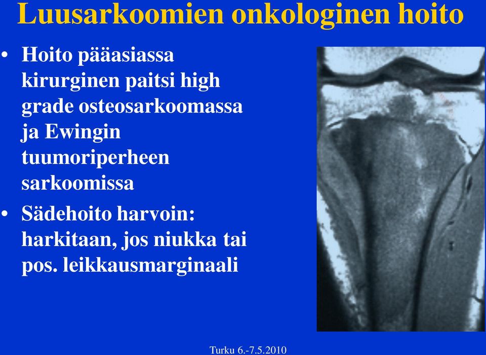 Ewingin tuumoriperheen sarkoomissa Sädehoito