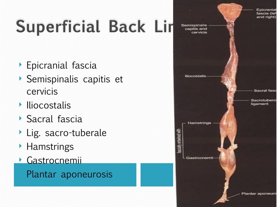 Iliocostalis Sacral fascia Lig.