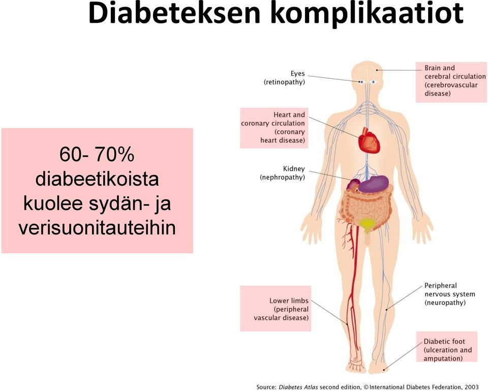 diabeetikoista
