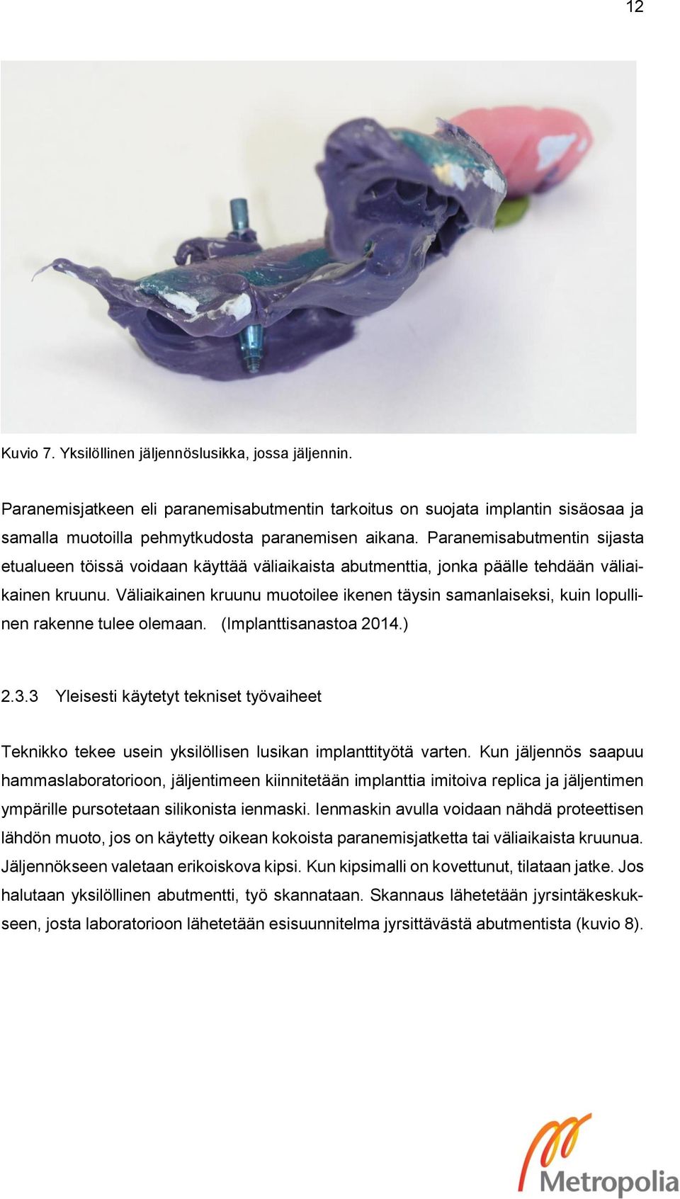 Väliaikainen kruunu muotoilee ikenen täysin samanlaiseksi, kuin lopullinen rakenne tulee olemaan. (Implanttisanastoa 2014.) 2.3.