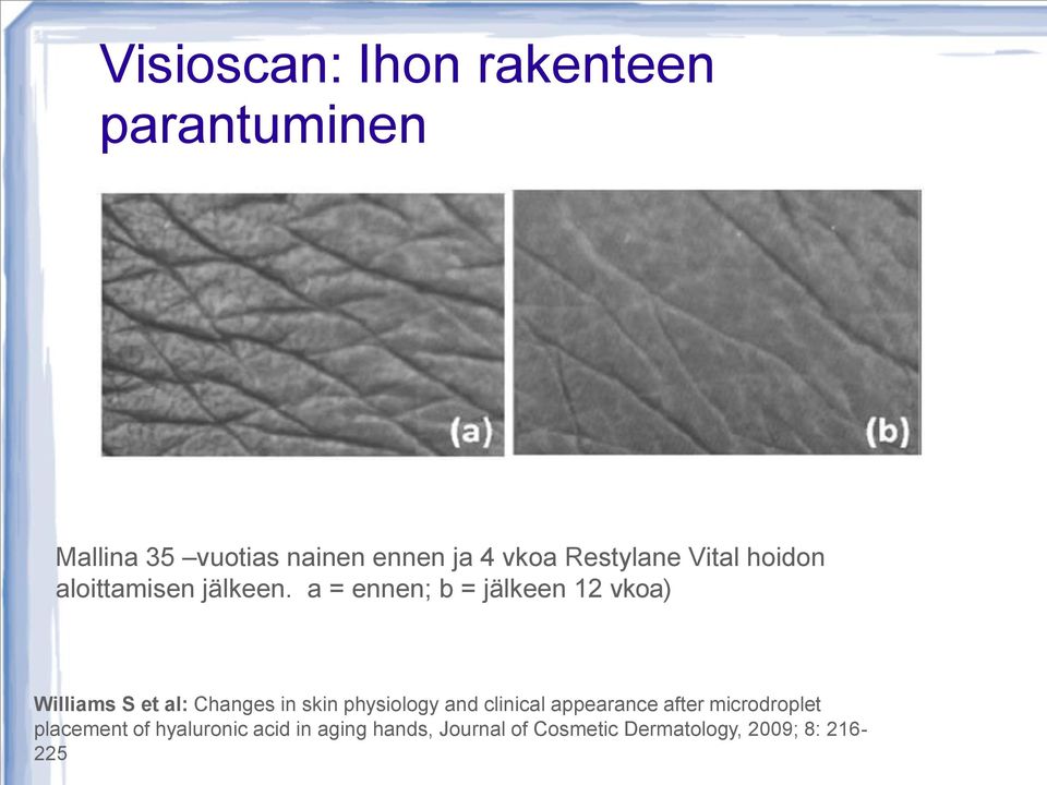 a = ennen; b = jälkeen 12 vkoa) Williams S et al: Changes in skin physiology and