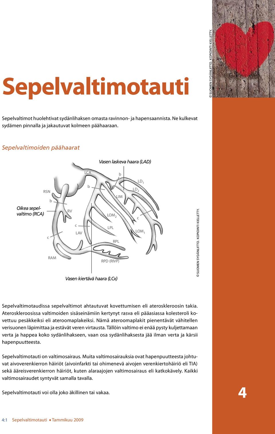 Kopiointi kieetty. Sepevatimotaudissa sepevatimot ahtautuvat kovettumisen ei ateroskeroosin takia.