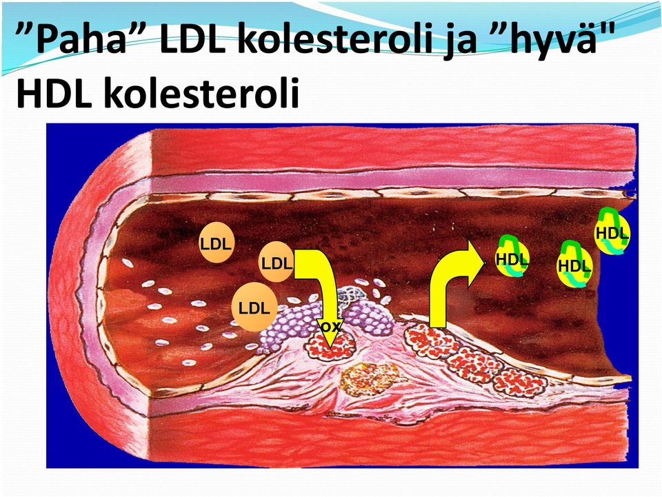 hyvä" HDL