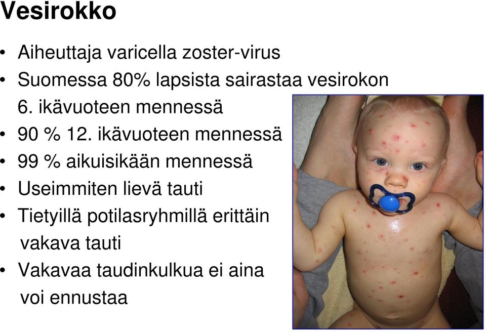 ikävuoteen mennessä 99 % aikuisikään mennessä Useimmiten lievä tauti