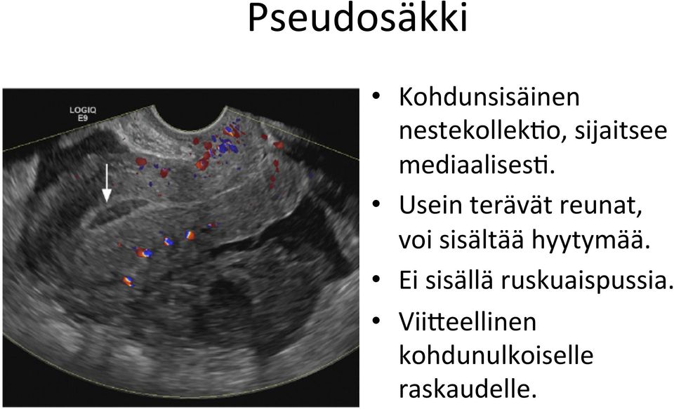 Usein terävät reunat, voi sisältää hyytymää.