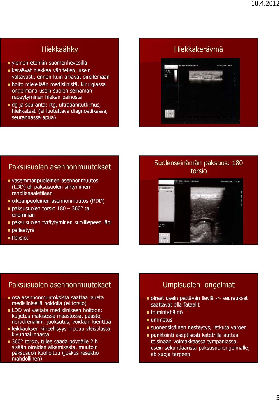 asennonmuutos (LDD) eli paksusuolen siirtyminen renolienaaletilaan oikeanpuoleinen asennonmuutos (RDD) paksusuolen torsio 180 360 tai enemmän paksusuolen tyräytyminen suoliliepeen läpi palleatyrä
