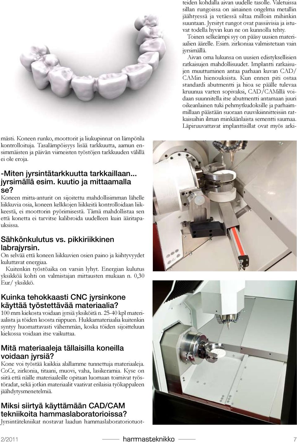 Aivan oma lukunsa on uusien edistyksellisien ratkaisujen mahdollisuudet. Implantti ratkaisujen muuttuminen antaa parhaan kuvan CAD/ CAMin hienouksista.